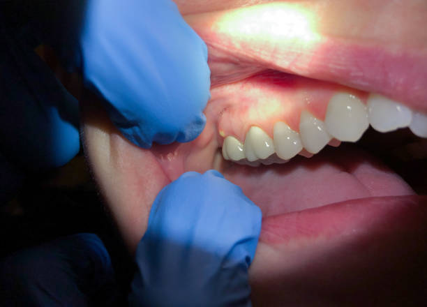 Best Emergency Dental Care for Broken or Chipped Teeth in Mackinac Island, MI